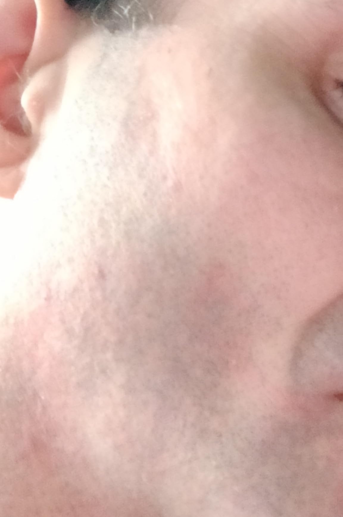 Meine Haut reagiert viel besser
